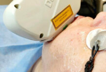 Все о процедуре фотоомоложения для вашего лица