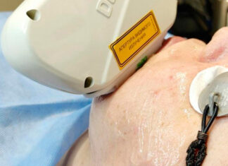 Все о процедуре фотоомоложения для вашего лица